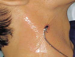 Hydrofilm(1)