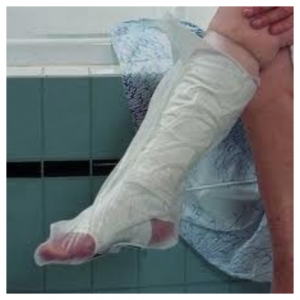 aquaprotect-protection-mollet